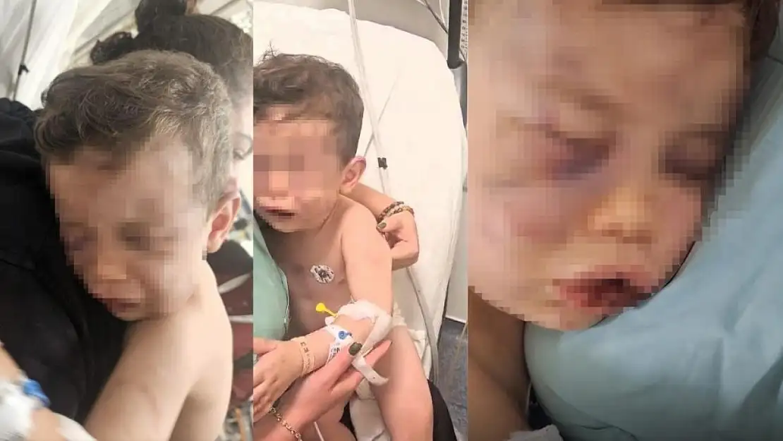 Acımasızca darp edilmişti: Aren bebek olayında flaş gelişme
