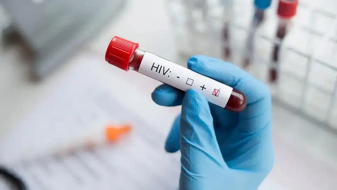 AIDS’te Yeni Umut Işığı: HIV’i Hücreden Ayırma Denemesi Başarılı Oldu!