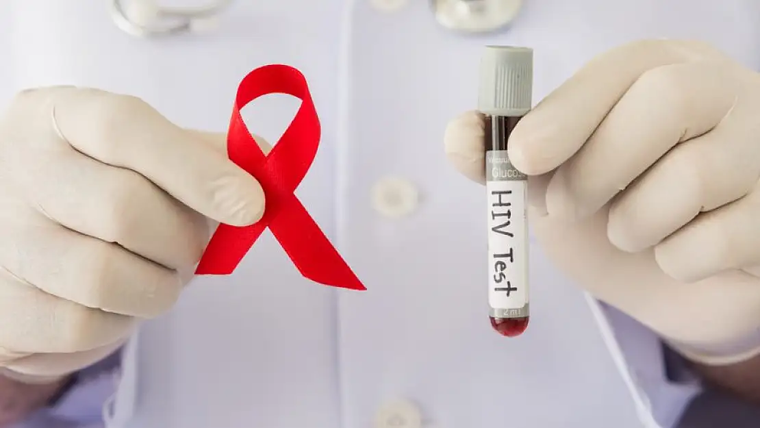 Dünya’da azalma gösteren HIV virüsü Türkiye’de yükselişte!