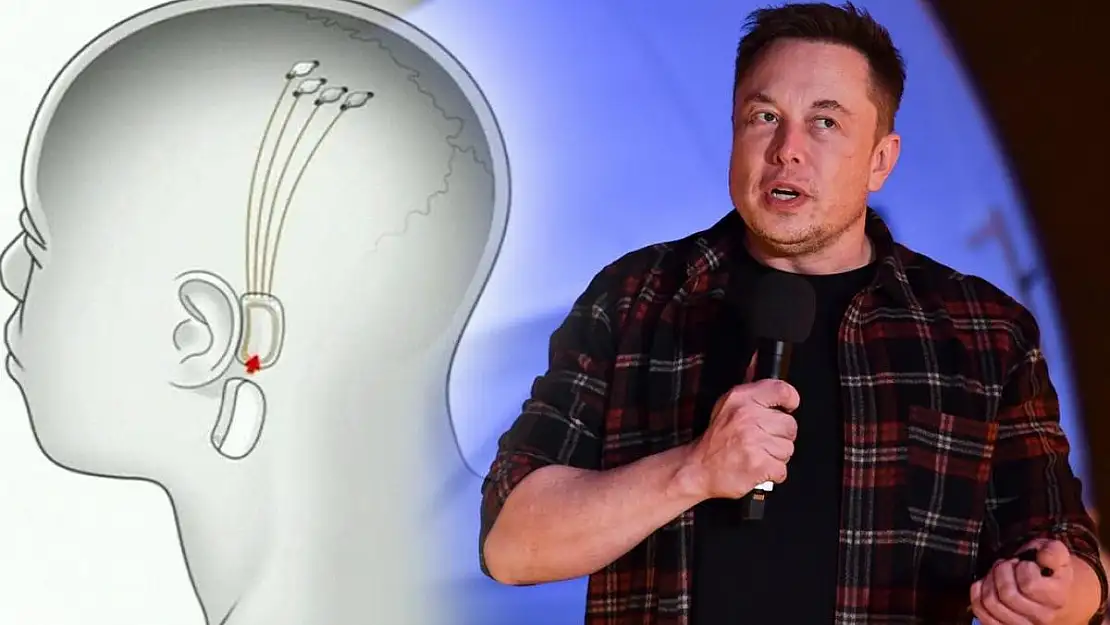 Elon Musk, insanların beynine mikroçip yerleştirmeye başlayacak…