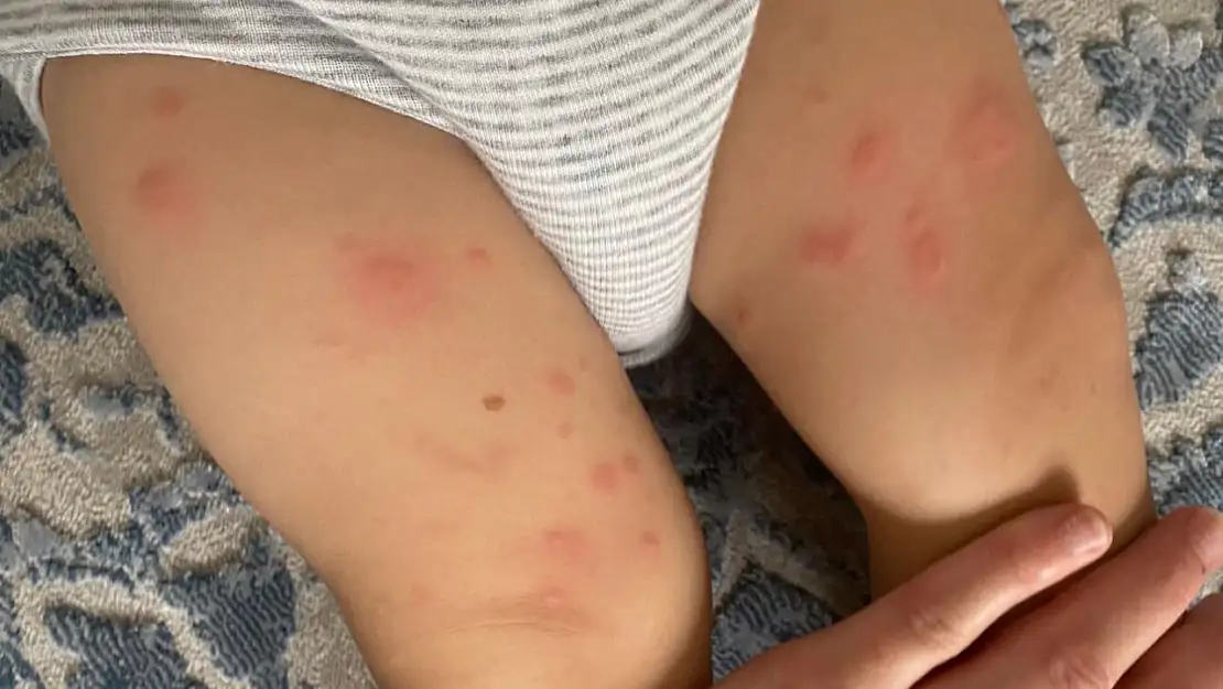 Her 17 çocuktan biri risk altında: Bu belirtiler hayati tehlike...