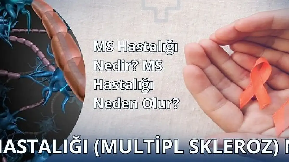 MS Hastalığı (Multipl Skleroz) Nedir?