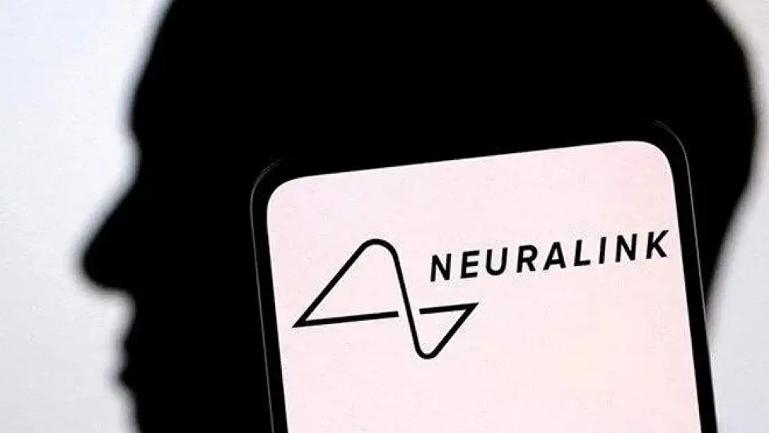 Neuralink, beyin çipiyle ilgili potansiyel riskleri biliyor muydu?