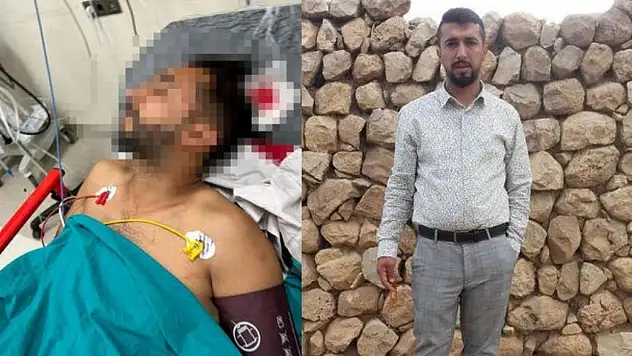 Döner yerken başından vuruldu: Yaşam mücadelesi veriyor