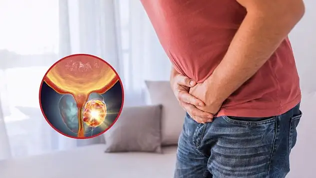 Prostat kanserine dikkat! Uzmanlardan kritik uyarı