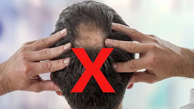 Saç dökülmesi neden olur? Saç dökülmelerine ne iyi gelir?